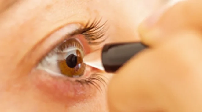 Paquimetría corneal